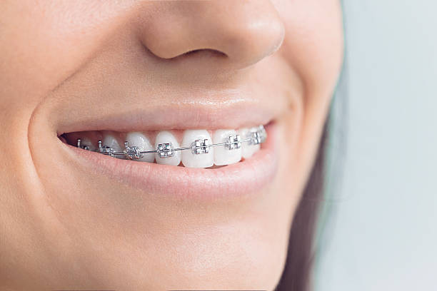 Why Choose Us for Your Dental Needs in Cape St Claire, MD